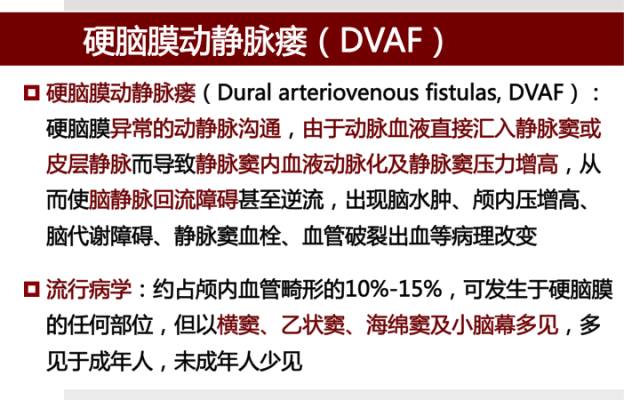 【病例】硬脑膜动静脉瘘1例