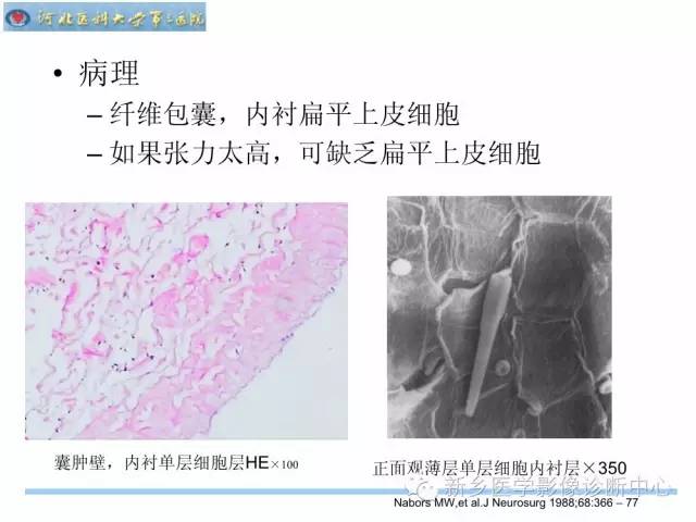 【PPT】椎管内囊性病变影像诊断