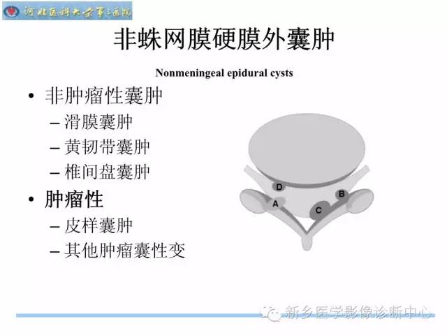 【PPT】椎管内囊性病变影像诊断