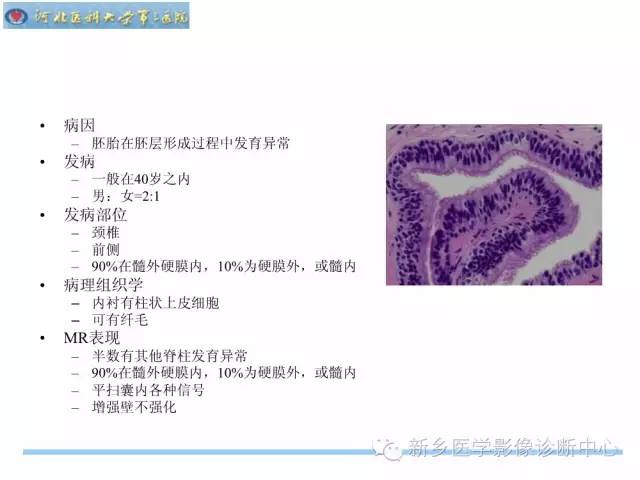 【PPT】椎管内囊性病变影像诊断