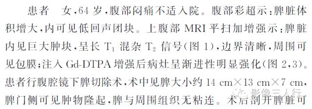 【病例】脾脏炎性假瘤1例MR影像表现