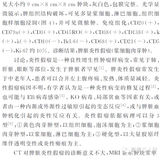 【病例】脾脏炎性假瘤1例MR影像表现