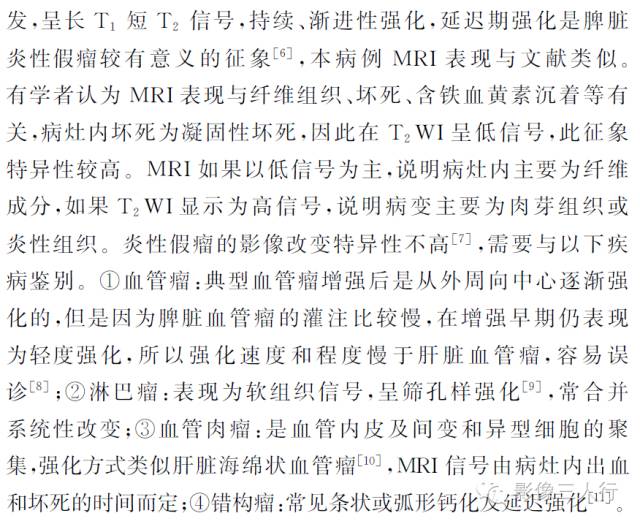 【病例】脾脏炎性假瘤1例MR影像表现
