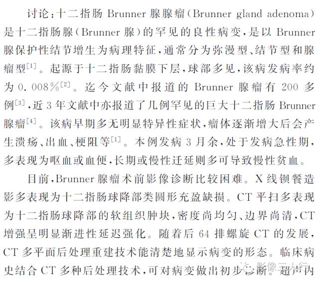 【病例】十二指肠Brunner腺腺瘤1例CT影像表现 【病例】十二指肠Brunner腺腺瘤1例CT影像表现