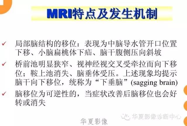 【病例】低颅压综合征IHS一例MR影像表现