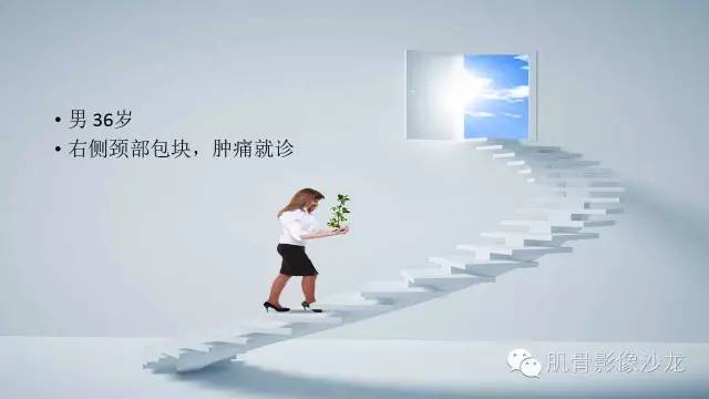 【病例】恶性外周神经鞘瘤2例MR影像表现