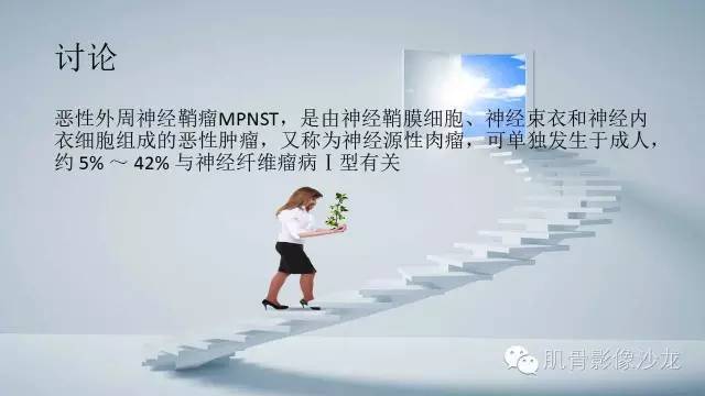 【病例】恶性外周神经鞘瘤2例MR影像表现