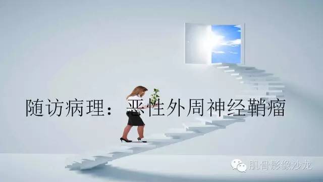 【病例】恶性外周神经鞘瘤2例MR影像表现