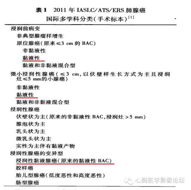 【病例】粘液型肺腺癌3例CT影像表现与分析 【病例】粘液型肺腺癌3例CT影像表现与分析