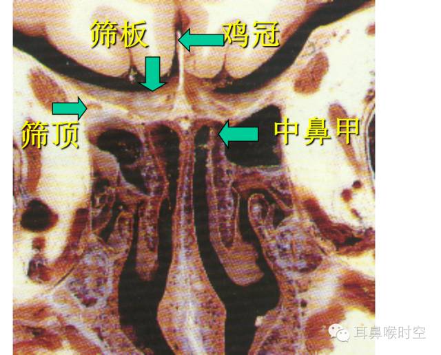 经常看鼻窦,您知道鼻窦的哪些变异与鼻窦炎和手术有关系吗? 经常看鼻窦,您知道鼻窦的哪些变异与鼻窦炎和手术有关系吗?