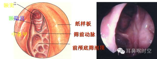 经常看鼻窦,您知道鼻窦的哪些变异与鼻窦炎和手术有关系吗? 经常看鼻窦,您知道鼻窦的哪些变异与鼻窦炎和手术有关系吗?