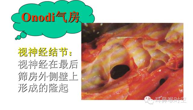 经常看鼻窦,您知道鼻窦的哪些变异与鼻窦炎和手术有关系吗? 经常看鼻窦,您知道鼻窦的哪些变异与鼻窦炎和手术有关系吗?