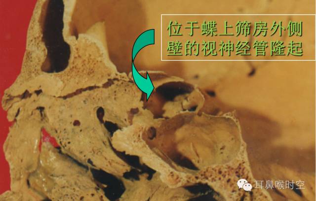 经常看鼻窦,您知道鼻窦的哪些变异与鼻窦炎和手术有关系吗? 经常看鼻窦,您知道鼻窦的哪些变异与鼻窦炎和手术有关系吗?
