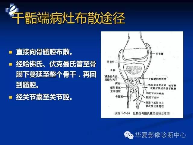 【PPT】骨与关节感染的影像学诊断