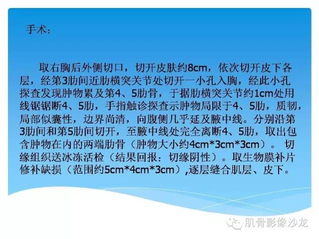 【病例】婴幼儿胸壁错构瘤1例CT影像表现 【病例】婴幼儿胸壁错构瘤1例CT影像表现