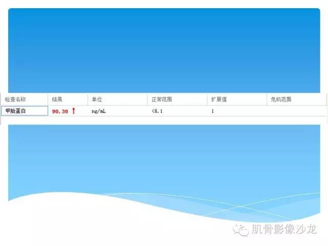 【病例】婴幼儿胸壁错构瘤1例CT影像表现 【病例】婴幼儿胸壁错构瘤1例CT影像表现