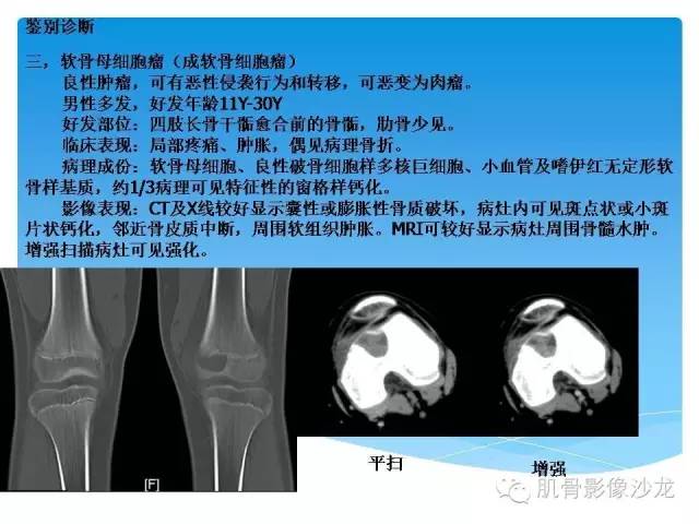 【病例】婴幼儿胸壁错构瘤1例CT影像表现 【病例】婴幼儿胸壁错构瘤1例CT影像表现