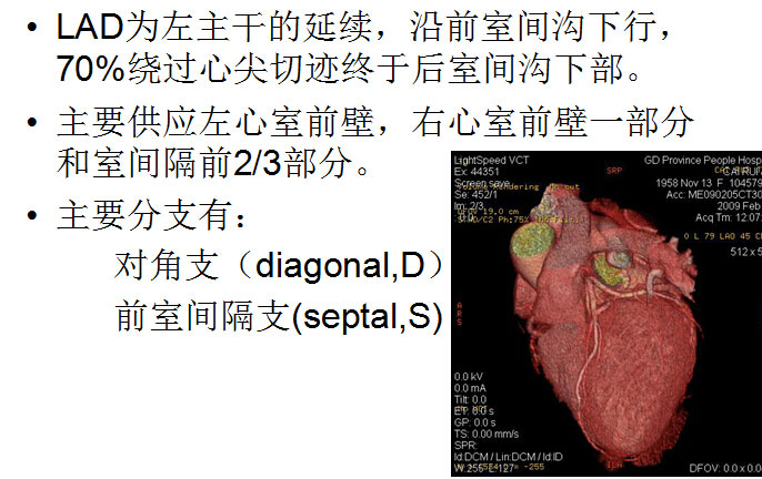 【PPT】正常冠状动脉解剖