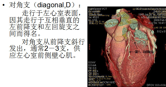 【PPT】正常冠状动脉解剖