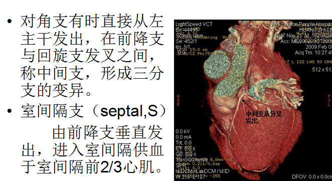 【PPT】正常冠状动脉解剖