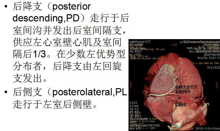 【PPT】正常冠状动脉解剖