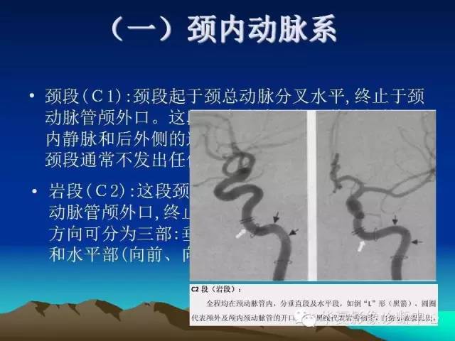 【PPT】脑血管详细解剖带分段