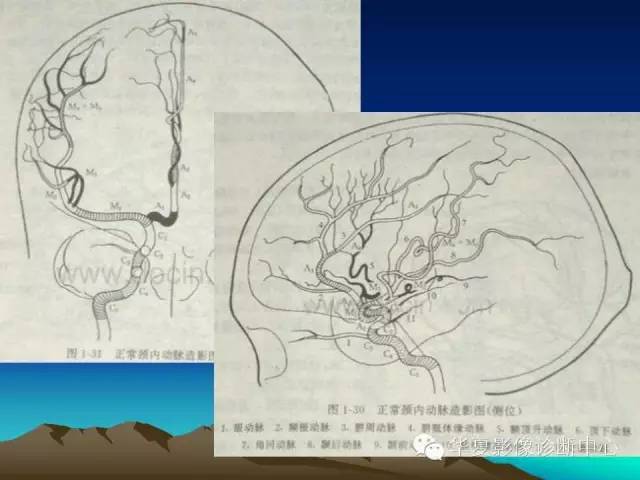 【PPT】脑血管详细解剖带分段