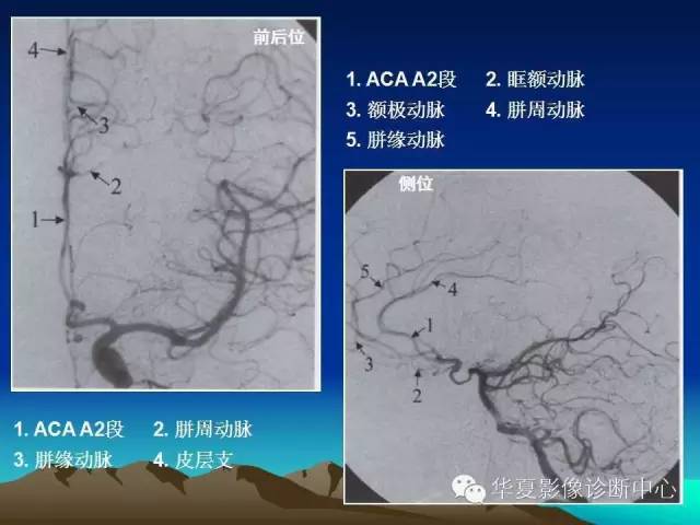 【PPT】脑血管详细解剖带分段