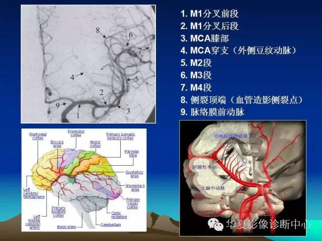 【PPT】脑血管详细解剖带分段