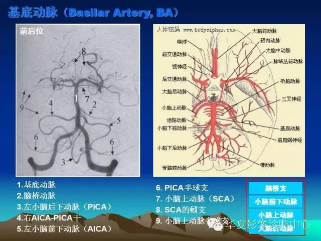 【PPT】脑血管详细解剖带分段