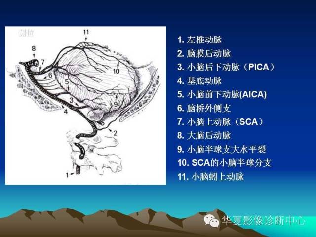 【PPT】脑血管详细解剖带分段