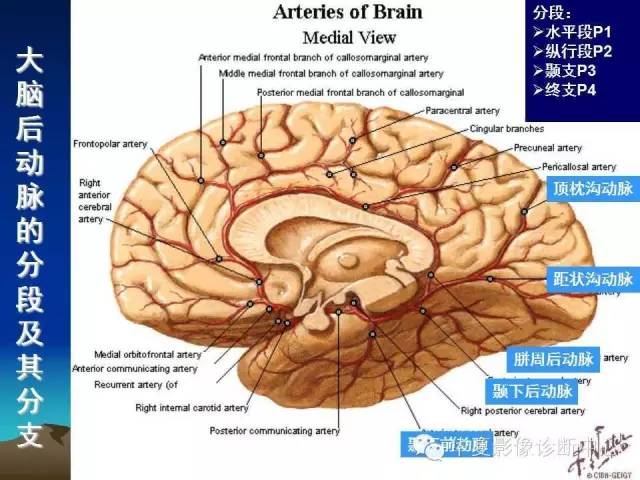 【PPT】脑血管详细解剖带分段