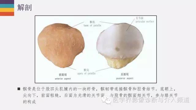 【PPT】髌股关节MR