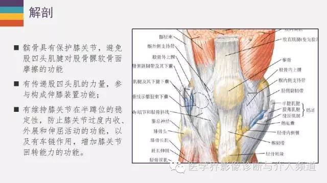 【PPT】髌股关节MR