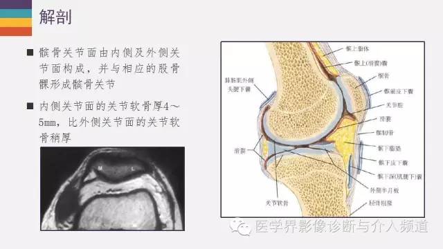 【PPT】髌股关节MR