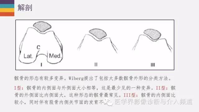 【PPT】髌股关节MR