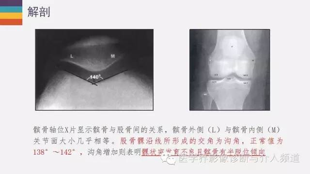 【PPT】髌股关节MR
