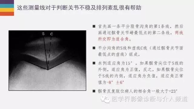 【PPT】髌股关节MR