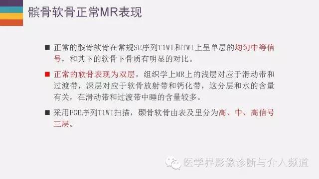 【PPT】髌股关节MR