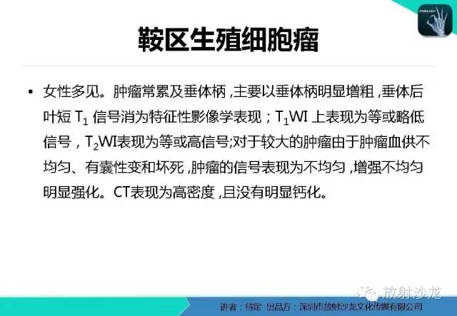 【病例】松果体区生殖细胞瘤1例CT及MR影像表现