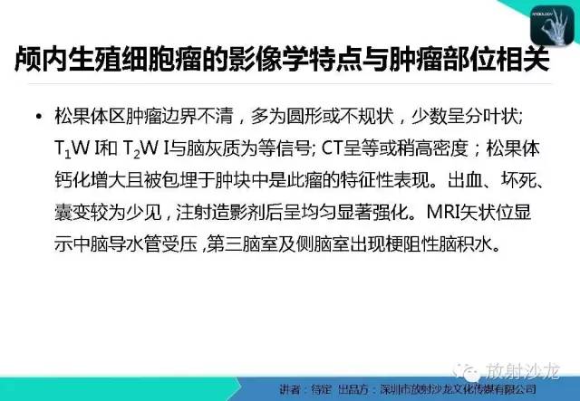 【病例】松果体区生殖细胞瘤1例CT及MR影像表现