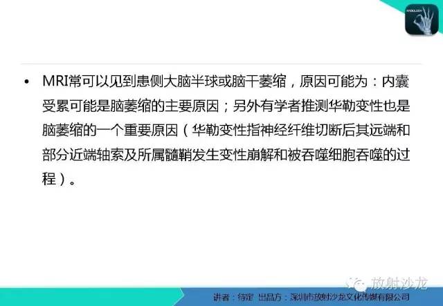 【病例】松果体区生殖细胞瘤1例CT及MR影像表现