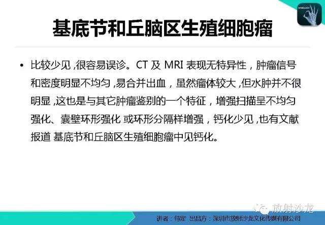 【病例】松果体区生殖细胞瘤1例CT及MR影像表现
