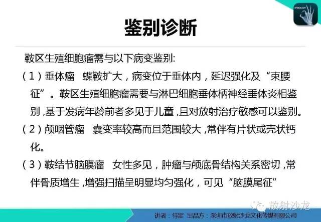 【病例】松果体区生殖细胞瘤1例CT及MR影像表现