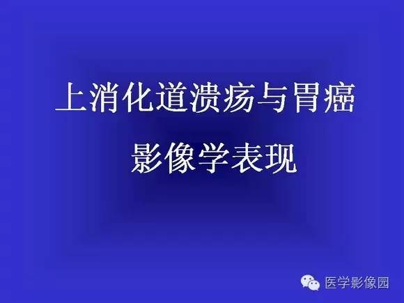 【PPT】上消化道溃疡与胃癌的影像学表现