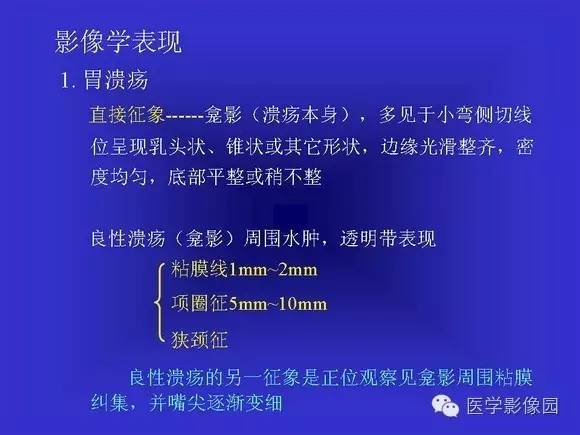 【PPT】上消化道溃疡与胃癌的影像学表现