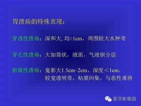 【PPT】上消化道溃疡与胃癌的影像学表现
