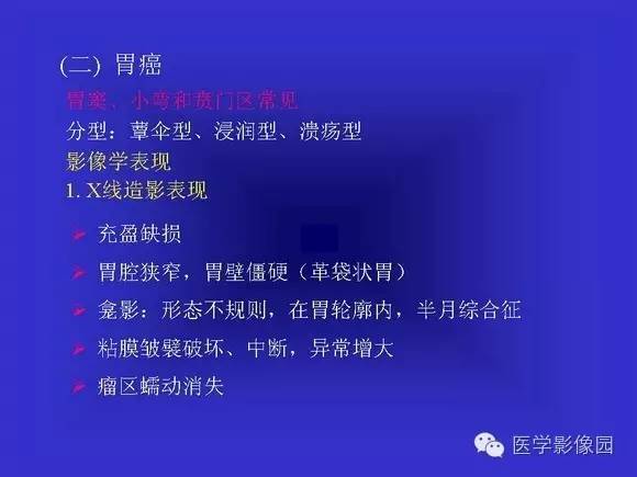 【PPT】上消化道溃疡与胃癌的影像学表现