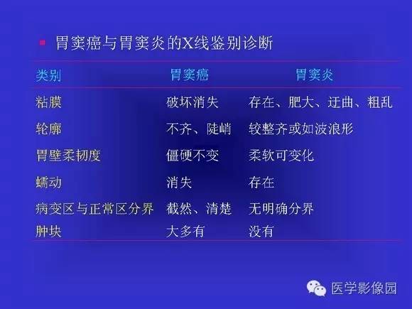 【PPT】上消化道溃疡与胃癌的影像学表现
