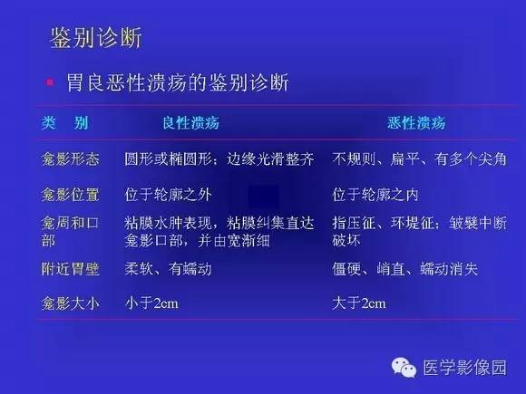 【PPT】上消化道溃疡与胃癌的影像学表现